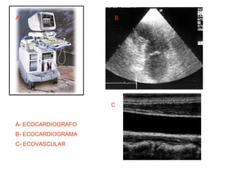 A B C A- ECOCARDIOGRAFO B- ECOCARDIOGRAMA C- ECOVASCULAR 