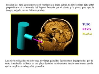 Posición del tubo con respecto con respecto a la pieza dental. El rayo central debe estar perpendicular a la bisectriz del ángulo formado por el diente y la placa, para que la imagen salga lo menos deforme posible.  Las placas utilizadas en radiología no tienen pantallas fluorescentes incorporadas, por lo tanto la radiación utilizada en una placa dental es relativamente mucho mas intensa que la que se emplea en radiografías generales.  TUBO RAYO PLACA 