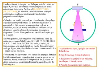 La obtención de la imagen esta dada por un tubo emisor de rayos X, que esta enfrentado con mucha precisión a una columna de detectores. Ambos, el  BLOQUE TUBO-DETECTORES , se moverán sincrónicamente, siempre enfrentados, con lo que se obtendrán las distintas proyecciones del objeto. Cada detector tendrá un canal por el cual enviar á  los pulsos eléctricos correspondientes a las distintas mediciones al computador. Este mismo, se encargar á  de ordenar y almacenar, todos los pulsos recibidos de cada uno de los detectores y archivarlos en la memoria o en un disco magnético. De ese disco, podrán ser extraídos siempre que se lo desee. En otras palabras, los detectores convierten una señal de radiación en una señal eléctrica, SI o NO, ES DECIR: HAY PULSO O NO HAY PULSO. Esta señal, a su vez, se transforma en una señal digital por medio de un conversor análogo digital, con el cual   obtendremos como resultado: 0  o 1 según haya o no pulso . Físicamente, los detectores, s ó lo suman las energías de todos los fotones recibidos  como tonos de grises , y las envían en forma de pulsos eléctricos al computador. En él, todos los datos numéricos, son procesados para la reconstrucción de las imágenes. 1-Generador de rayos, que gira en sentido de la flecha.  2-Haz de rayos en forma de abanico  3- Sección de la cabeza de un paciente, barrida por el haz de rayos.  4-Pantalla fluorescente con Detector. 1 2 3 4 