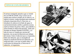 El primer tomógrafo operativo que se instal ó  fue un EMI-SCANER.  (Fig 1)  Este era un equipo para realizar estudios de la cabeza y su aspecto externo, estaba diseñado para mantener cómodo al paciente.(F ig   2 ). Para esto, se introducía la cabeza en un baño de agua, lo cual posteriormente cambio a gelatina acuosa, sujeta en bolsas de goma o látex, que rodeaba e inmovilizaba la cabeza del paciente. Todo esto formaba un bloque llamado GANTRY, y el tubo de rayos se situaba por encima del paciente, con un par de detectores por debajo del mismo. Entre el tubo de rayos y el paciente, había otro detector, que se encargaba de obtener la medición del haz de radiación, a la salida del tubo y con esto se podía saber, el coeficiente de atenuación, al atravesar la radiación , el organismo. 2 TIPOS DE EXPLORADORES 1 