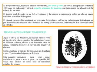 El bloque mecánico, hac í a dos tipos de movimiento,  uno lineal y corto , de cabeza a los pies que se repetía 180 veces en cada corte y otro de  rotación alrededor del paciente,  que tenia como eje el centro de la cabeza del paciente. El tiempo total de corte era de 4,5 a 5 minutos y la imagen se reconstruya sobre un tubo de rayos catódicos o monitor de imágenes. El tubo de rayos recibía tensión de un generador de tres fases, y el haz de radiación era limitado por un par de colimadores situados uno a la salida del tubo y el otro cerca de cada detector. Los detectores eran de SODIO.  PRIMERA GENERACION DE TOMOGRAFOS Aquí, el tubo y los detectores, se mueven en línea recta de los pies a la cabeza  mientras  dura el disparo. Luego se detienen. Además, el tubo y los detectores rotan un grado, comienza de nuevo el movimiento lineal y el disparo.  En la actualidad  el sentido del moviendo es de cabeza a pies. Terminando el disparo, se detienen. Este proceso: trasladarse – parar – rotar - parar, trasladarse – parar – rotar - parar, es repetido 180 veces para obtener un corte. Soló se realizaban estudios del cráneo. PRIMER IMAGEN TOMOGRAFICA: CEREBRO 