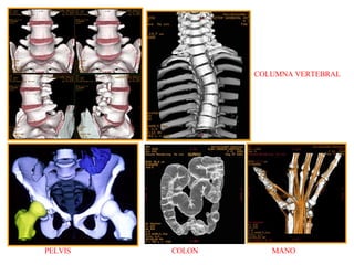 COLUMNA VERTEBRAL PELVIS COLON MANO 