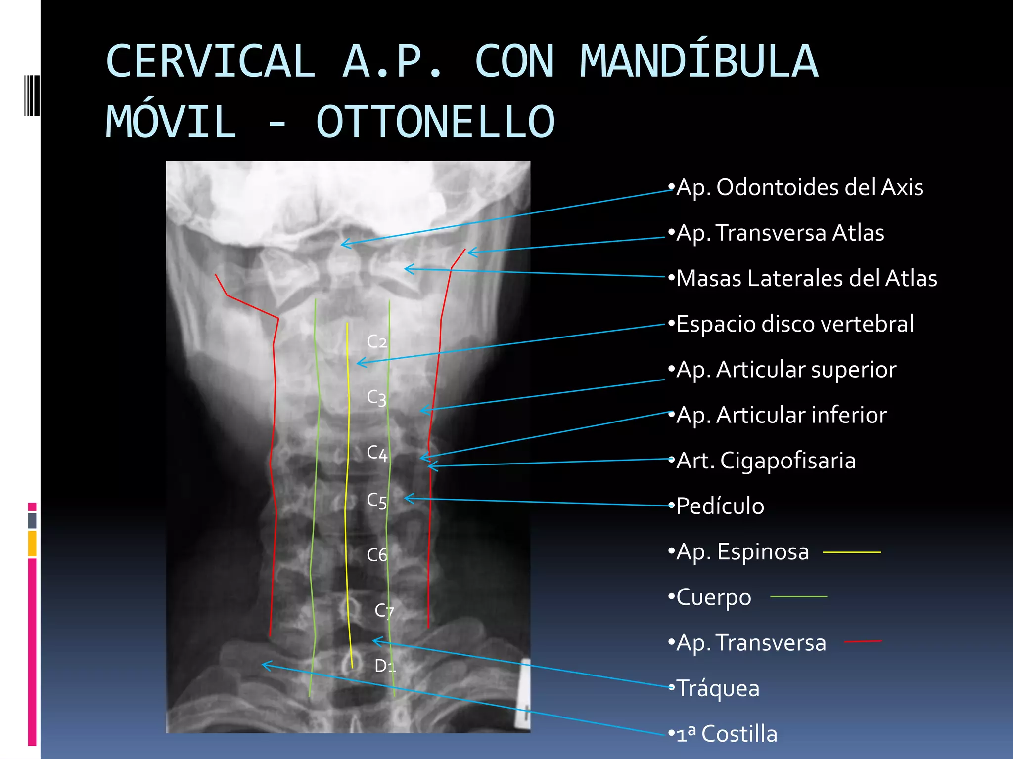 Manual rx columna vertebral | PPTX