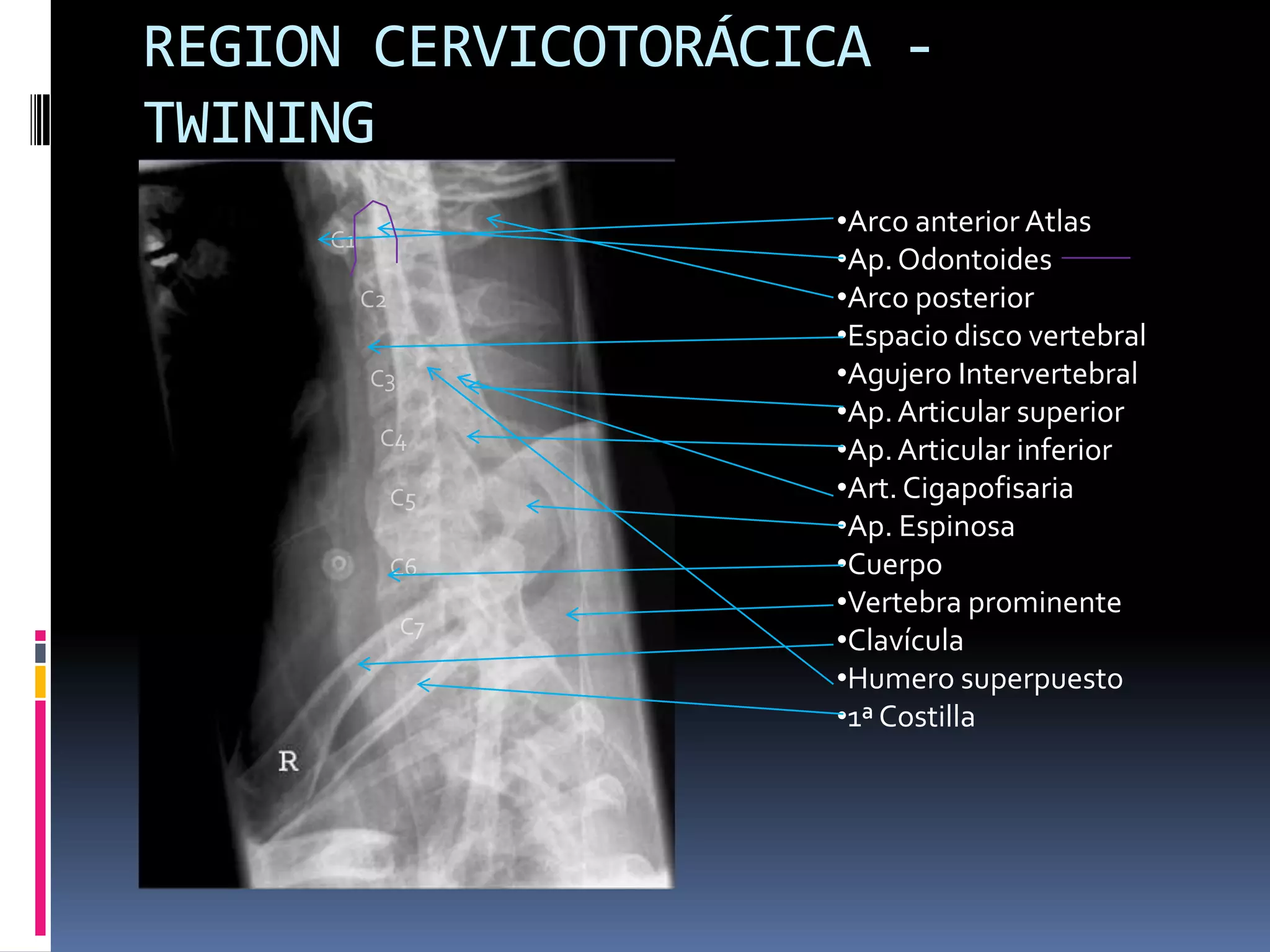 Manual rx columna vertebral | PPTX