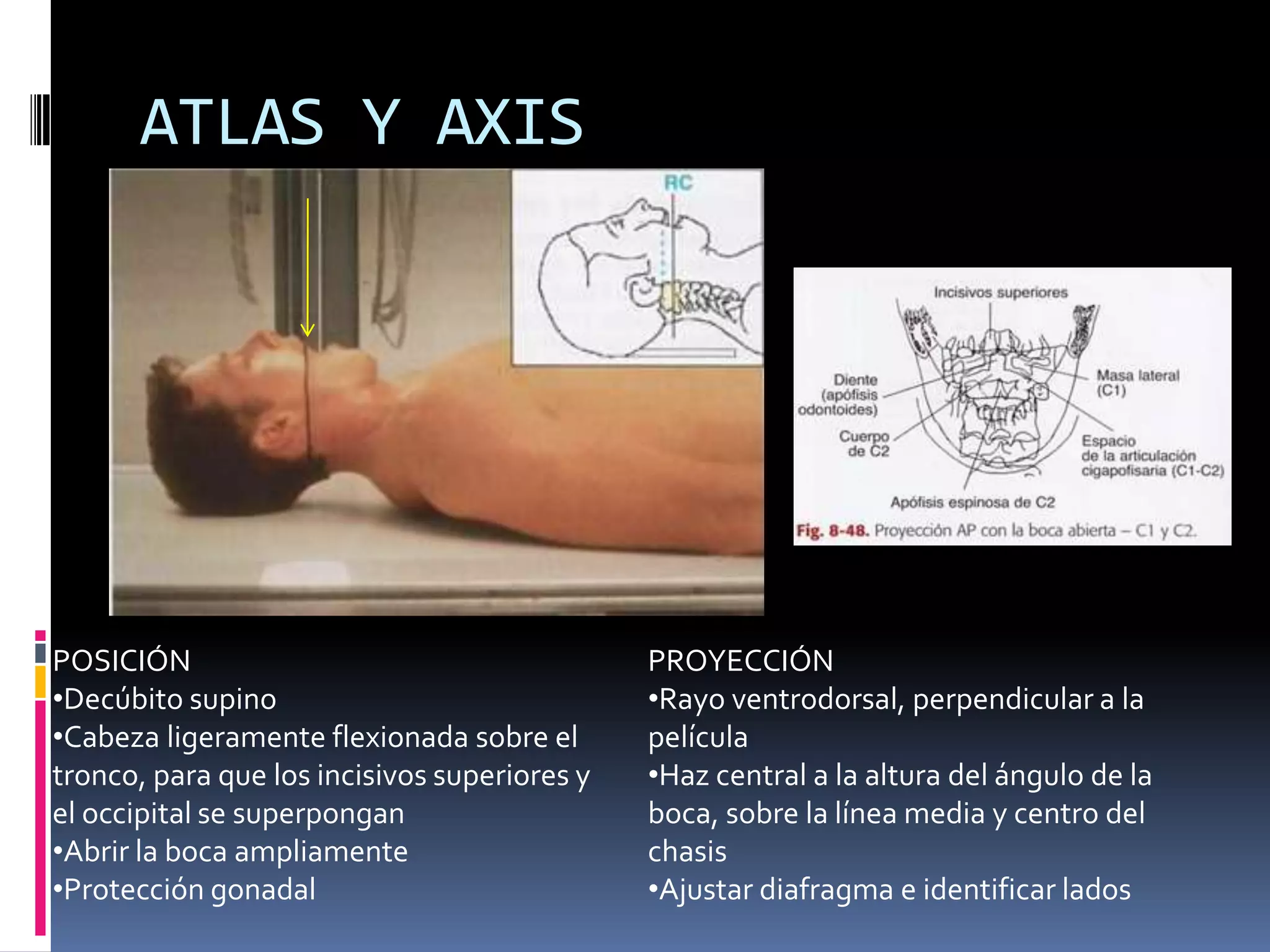 Manual rx columna vertebral | PPTX