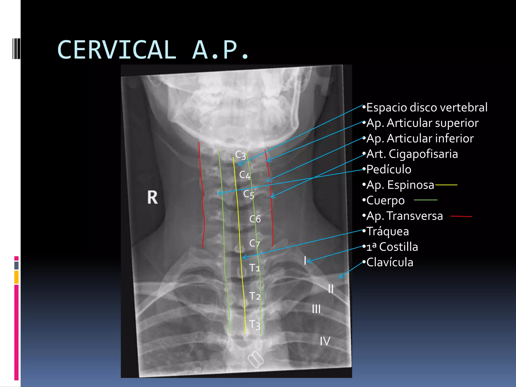 Manual rx columna vertebral | PPTX
