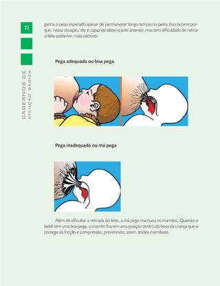 22
CADERNOSDE
ATENÇÃOBÁSICA
ganha o peso esperado apesar de permanecer longo tempo no peito.Isso ocorre por-
que, nessa situação, ele é capaz de obter o leite anterior, mas tem diﬁculdade de retirar
o leite posterior, mais calórico.
Pega adequada ou boa pega
Pega inadequada ou má pega
Além de diﬁcultar a retirada do leite, a má pega machuca os mamilos. Quando o
bebê tem uma boa pega, o mamilo ﬁca em uma posição dentro da boca da criança que o
protege da fricção e compressão, prevenindo, assim, lesões mamilares.
 