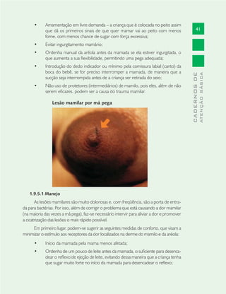 41
CADERNOSDE
ATENÇÃOBÁSICA
Amamentação em livre demanda – a criança que é colocada no peito assim•
que dá os primeiros sinais de que quer mamar vai ao peito com menos
fome, com menos chance de sugar com força excessiva;
Evitar ingurgitamento mamário;•
Ordenha manual da aréola antes da mamada se ela estiver ingurgitada, o•
que aumenta a sua ﬂexibilidade, permitindo uma pega adequada;
Introdução do dedo indicador ou mínimo pela comissura labial (canto) da•
boca do bebê, se for preciso interromper a mamada, de maneira que a
sucção seja interrompida antes de a criança ser retirada do seio;
Não uso de protetores (intermediários) de mamilo, pois eles, além de não•
serem eﬁcazes, podem ser a causa do trauma mamilar.
Lesão mamilar por má pega
1.9.5.1 Manejo
As lesões mamilares são muito dolorosas e, com freqüência, são a porta de entra-
da para bactérias. Por isso, além de corrigir o problema que está causando a dor mamilar
(na maioria das vezes a má pega), faz-se necessário intervir para aliviar a dor e promover
a cicatrização das lesões o mais rápido possível.
Em primeiro lugar, podem-se sugerir as seguintes medidas de conforto, que visam a
minimizar o estímulo aos receptores da dor localizados na derme do mamilo e da aréola:
Início da mamada pela mama menos afetada;•
Ordenha de um pouco de leite antes da mamada, o suﬁciente para desenca-•
dear o reﬂexo de ejeção de leite, evitando dessa maneira que a criança tenha
que sugar muito forte no início da mamada para desencadear o reﬂexo;
 