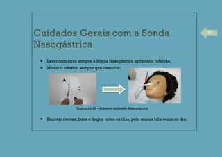 24
Cuidados Gerais com a Sonda
Nasogástrica
Lavar com água sempre a Sonda Nasogástrica após cada refeição;
Mudar o adesivo sempre que descolar;
Escovar dentes, boca e língua todos os dias, pelo menos três vezes ao dia;
Ilustração 12 – Adesivo da Sonda Nasogástrica
 