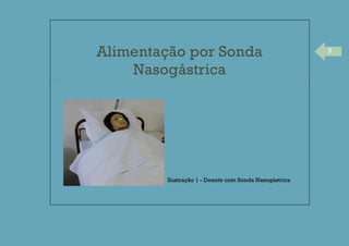 5
Alimentação por Sonda
Nasogástrica
Ilustração 1 - Doente com Sonda Nasogástrica
 