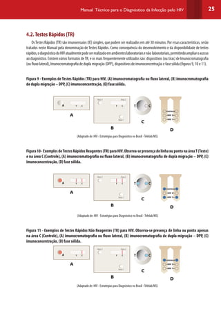 25Manual Técnico para o Diagnóstico da Infecção pelo HIV
4.2.Testes Rápidos (TR)
OsTestes Rápidos (TR) são imunoensaios (IE) simples, que podem ser realizados em até 30 minutos. Por essas características, serão
tratados neste Manual pela denominação de Testes Rápidos. Como consequência do desenvolvimento e da disponibilidade de testes
rápidos,odiagnósticodoHIVatualmentepodeserrealizadoemambienteslaboratoriaisenão laboratoriais,permitindoampliaroacesso
ao diagnóstico. Existem vários formatos deTR, e os mais frequentemente utilizados são: dispositivos (ou tiras) de Imunocromatografia
(ou fluxo lateral), Imunocromatografia de dupla migração (DPP), dispositivos de imunoconcentração e fase sólida (figuras 9, 10 e 11).
Figura 9 - Exemplos de Testes Rápidos (TR) para HIV, (A) imunocromatografia ou fluxo lateral, (B) imunocromatografia
de dupla migração – DPP, (C) imunoconcentração, (D) fase sólida.
A
Área 3 Área 2
Área 1
T TC C T C
HIV 2
HIV 1
CONTROLE
(Adaptado de: HIV - Estratégias para Diagnóstico no Brasil -Telelab/MS)
Figura10-ExemplosdeTestesRápidosReagentes(TR)paraHIV.Observa-sepresençadelinhaoupontonaáreaT(Teste)
e na área C (Controle), (A) imunocromatografia ou fluxo lateral, (B) imunocromatografia de dupla migração – DPP, (C)
imunoconcentração, (D) fase sólida.
A
Área 3 Área 2
Área 1
T TC C T C
HIV 2
HIV 1
CONTROLE
(Adaptado de: HIV - Estratégias para Diagnóstico no Brasil -Telelab/MS)
Figura 11 - Exemplos de Testes Rápidos Não Reagentes (TR) para HIV. Observa-se presença de linha ou ponto apenas
na área C (Controle), (A) imunocromatografia ou fluxo lateral, (B) imunocromatografia de dupla migração – DPP, (C)
imunoconcentração, (D) fase sólida.
A
Área 3 Área 2
Área 1
T TC C T C
HIV 2
HIV 1
CONTROLE
(Adaptado de: HIV - Estratégias para Diagnóstico no Brasil -Telelab/MS)
A
A
A
B
B
B
C
C
C
D
D
D
 