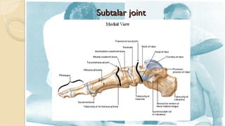 Subtalar Bar FISIOTERAPI MANUAL TERAPI PADA REGIO ANKLE.ppt