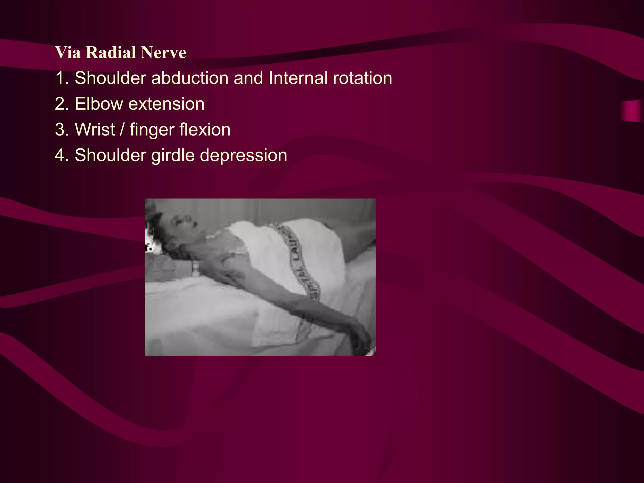 Via Radial Nerve
1. Shoulder abduction and Internal rotation
2. Elbow extension
3. Wrist / finger flexion
4. Shoulder girdle depression
 
