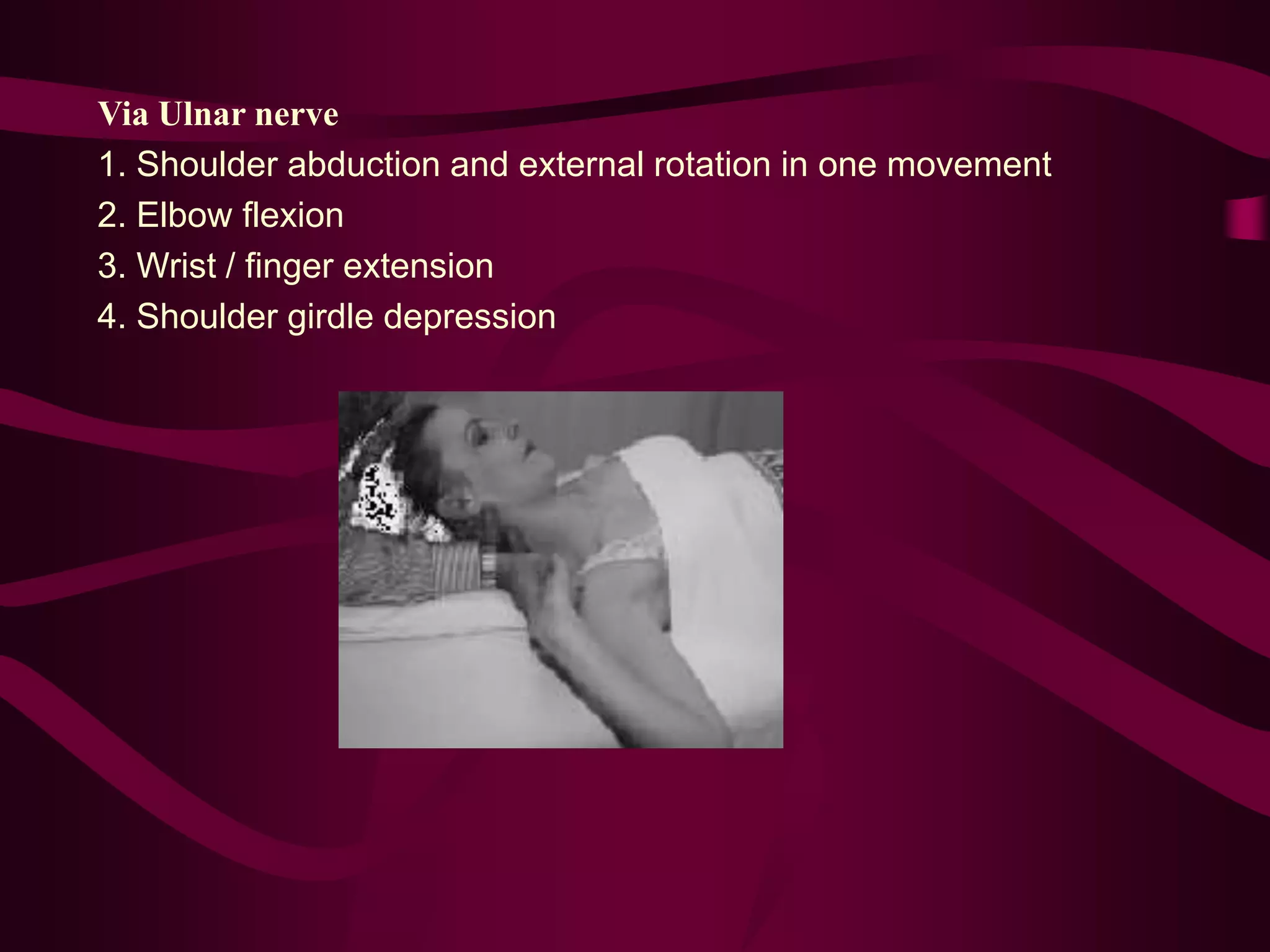 Via Ulnar nerve
1. Shoulder abduction and external rotation in one movement
2. Elbow flexion
3. Wrist / finger extension
4. Shoulder girdle depression
 