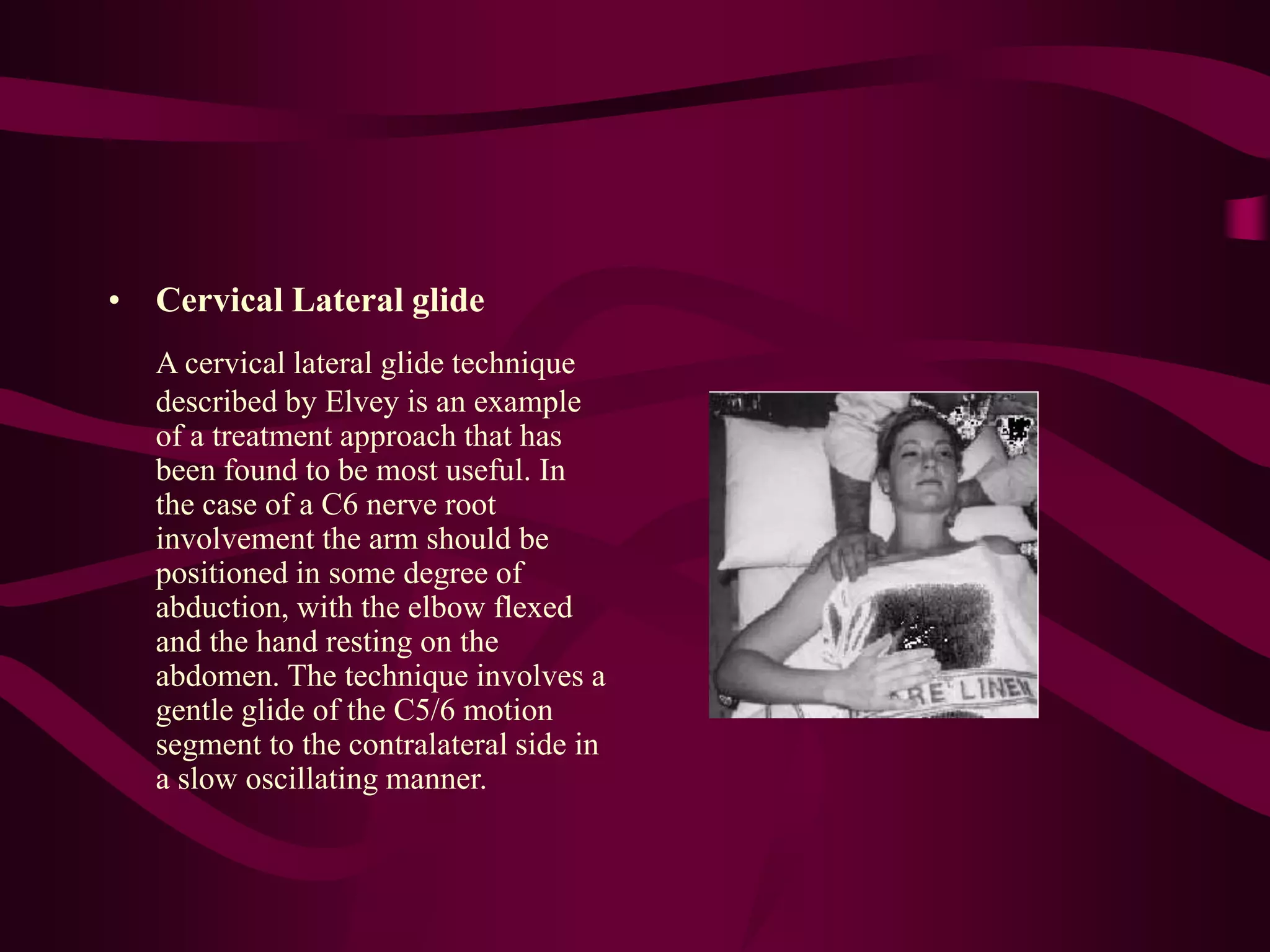 • Cervical Lateral glide
A cervical lateral glide technique
described by Elvey is an example
of a treatment approach that has
been found to be most useful. In
the case of a C6 nerve root
involvement the arm should be
positioned in some degree of
abduction, with the elbow flexed
and the hand resting on the
abdomen. The technique involves a
gentle glide of the C5/6 motion
segment to the contralateral side in
a slow oscillating manner.
 