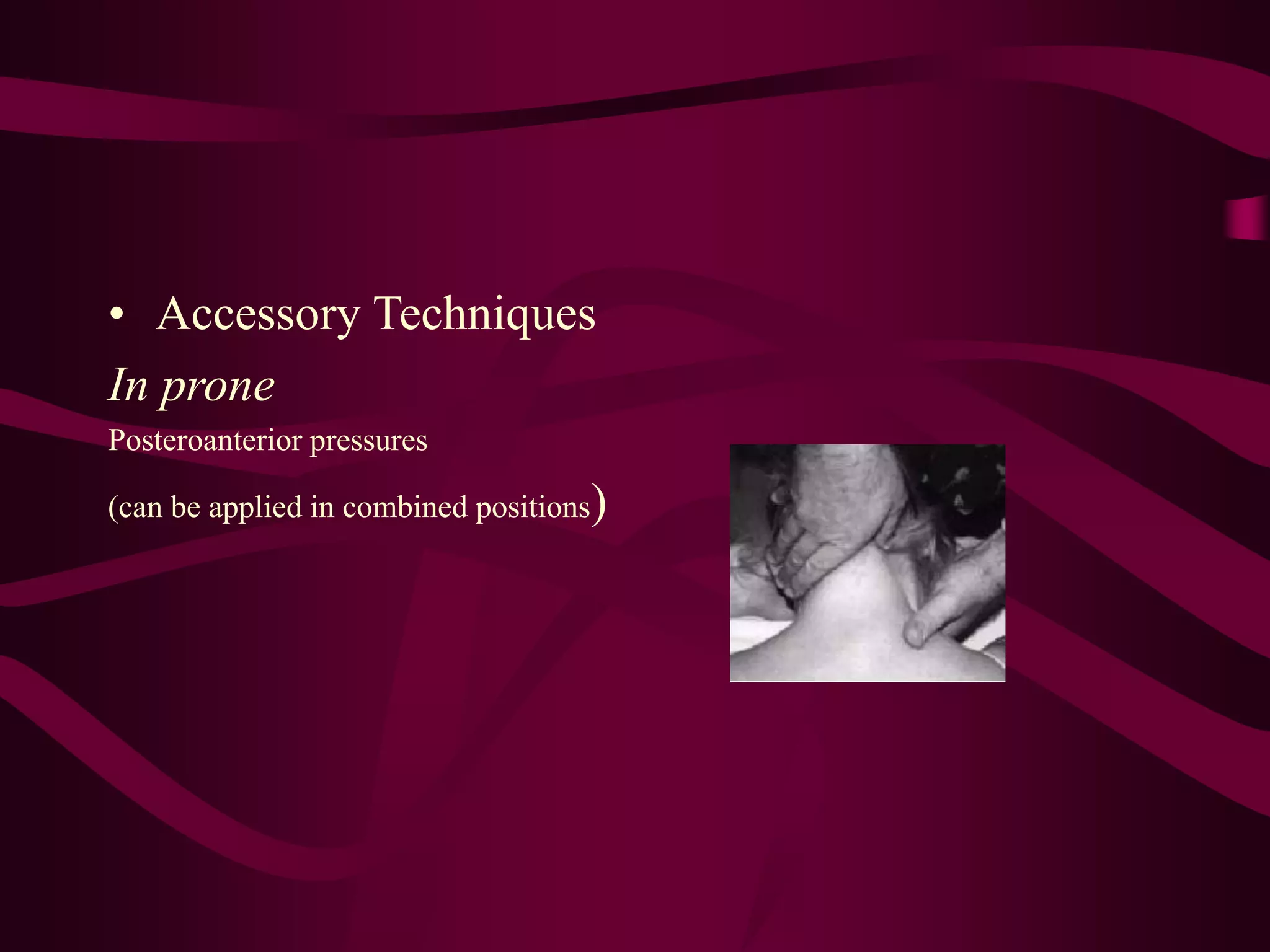 • Accessory Techniques
In prone
Posteroanterior pressures
(can be applied in combined positions)
 