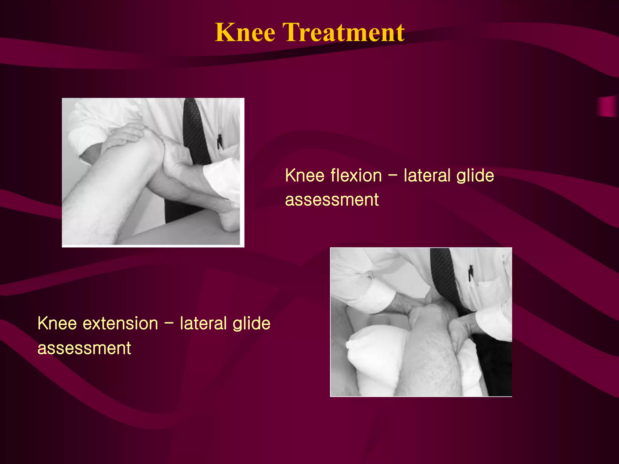 Knee Treatment
Knee flexion - lateral glide
assessment
Knee extension - lateral glide
assessment
 