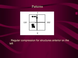Patterns
Regular compression for structures anterior on the
left
 