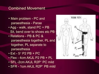 Combined Movement
• Main problem - PC and
paraesthesia - Parae
• Agg - walk, stand PC + PB
Sit, bend over to shoes etc PB +
• Relations - PB & PC &
paraesthesia together, PL and PB
together, PL separate to
paraesthesia
• Ext - 5° P2 PB + PC
• Flex - 4cm AKJL P2 PB + PL
• SFL -2cm AKJL R2P’ PC mild
• SFR - 1cm AKJL R2P’ PB mild
 