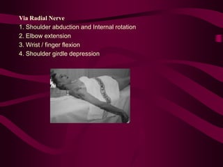 Via Radial Nerve
1. Shoulder abduction and Internal rotation
2. Elbow extension
3. Wrist / finger flexion
4. Shoulder girdle depression
 