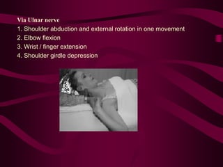 Via Ulnar nerve
1. Shoulder abduction and external rotation in one movement
2. Elbow flexion
3. Wrist / finger extension
4. Shoulder girdle depression
 