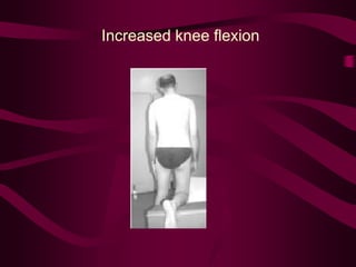 Increased knee flexion
 
