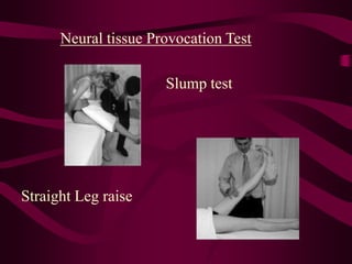 Neural tissue Provocation Test
Slump test
Straight Leg raise
 