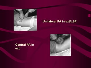 Unilateral PA in ext/LSF
Central PA in
ext
 