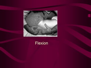 Flexion
 