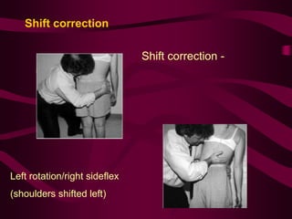 Shift correction
Shift correction -
standing
Left rotation/right sideflex
(shoulders shifted left)
 