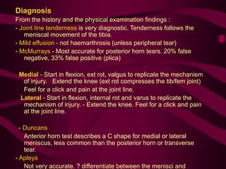 Diagnosis
From the history and the physical examination findings :
- Joint line tenderness is very diagnostic. Tenderness follows the
meniscal movement of the tibia.
- Mild effusion - not haemarthrosis (unless peripheral tear)
- McMurrays - Most accurate for posterior horn tears. 20% false
negative, 33% false positive (plica)
Medial - Start in flexion, ext rot, valgus to replicate the mechanism
of injury. Extend the knee (ext rot compresses the tib/fem joint)
Feel for a click and pain at the joint line.
Lateral - Start in flexion, internal rot and varus to replicate the
mechanism of injury. - Extend the knee. Feel for a click and pain
at the joint line.
- Duncans
Anterior horn test describes a C shape for medial or lateral
meniscus, less common than the posterior horn or transverse
tear.
- Apleys
Not very accurate. ? differentiate between the menisci and
 