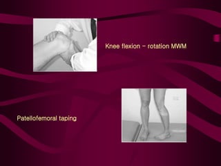 Knee flexion - rotation MWM
Patellofemoral taping
 