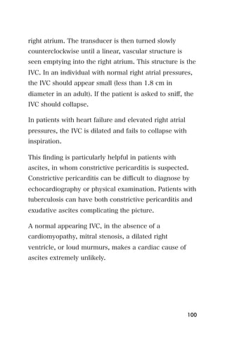right atrium. The transducer is then turned slowly
counterclockwise until a linear, vascular structure is
seen emptying into the right atrium. This structure is the
IVC. In an individual with normal right atrial pressures,
the IVC should appear small (less than 1.8 cm in
diameter in an adult). If the patient is asked to sniﬀ, the
IVC should collapse.

In patients with heart failure and elevated right atrial
pressures, the IVC is dilated and fails to collapse with
inspiration.

This ﬁnding is particularly helpful in patients with
ascites, in whom constrictive pericarditis is suspected.
Constrictive pericarditis can be diﬃcult to diagnose by
echocardiography or physical examination. Patients with
tuberculosis can have both constrictive pericarditis and
exudative ascites complicating the picture.

A normal appearing IVC, in the absence of a
cardiomyopathy, mitral stenosis, a dilated right
ventricle, or loud murmurs, makes a cardiac cause of
ascites extremely unlikely.




                                                           100
 