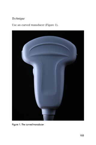 Technique

Use an curved transducer (Figure 1).




Figure 1. The curved transducer



                                       105
 