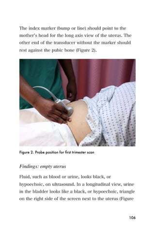 The index marker (bump or line) should point to the
mother s head for the long axis view of the uterus. The
other end of the transducer without the marker should
rest against the pubic bone (Figure 2).




Figure 2. Probe position for ﬁrst trimester scan



Findings: empty uterus

Fluid, such as blood or urine, looks black, or
hypoechoic, on ultrasound. In a longitudinal view, urine
in the bladder looks like a black, or hypoechoic, triangle
on the right side of the screen next to the uterus (Figure



                                                       106
 