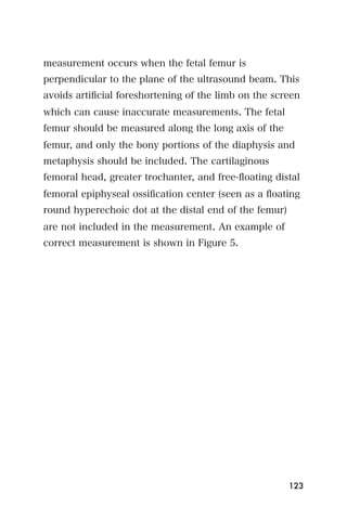 measurement occurs when the fetal femur is
perpendicular to the plane of the ultrasound beam. This
avoids artiﬁcial foreshortening of the limb on the screen
which can cause inaccurate measurements. The fetal
femur should be measured along the long axis of the
femur, and only the bony portions of the diaphysis and
metaphysis should be included. The cartilaginous
femoral head, greater trochanter, and free-ﬂoating distal
femoral epiphyseal ossiﬁcation center (seen as a ﬂoating
round hyperechoic dot at the distal end of the femur)
are not included in the measurement. An example of
correct measurement is shown in Figure 5.




                                                        123
 