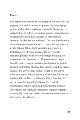 Cervix

It is important to measure the length of the cervix in the
pregnant 2nd and 3rd trimester patient. By identifying a
patient with a shortened or prematurely dilating cervix
early, before fetal loss, premature rupture of membranes
or premature labor, it is possible to prevent poor
outcome for the mother and fetus. Cervical insuﬃciency
(premature opening of the cervix) often occurs between
weeks 16 and 28 in single gestation pregnancies.
Unfortunately, physical exam of the cervix only
identiﬁes patients with cervical change involving the
external os and distal cervix. Ultrasound can help to
identify early changes involving the internal os which
happen well before changes that can be found by digital
exam of the cervix. The normal length of the cervix
from internal os to external os is more than 2.5 cm and
is often 3-4 cm. If cervical length (CL) is less than 2.5
cm or there is funneling (Figure 7), cervical
insuﬃciency can be suspected. Consultation with an
obstetrician for potential emergency cervical cerclage
(suture), bed rest, and pelvic rest (no internal exams or
intercourse) is indicated.




                                                            127
 