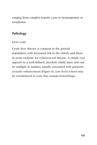 ranging from complex hepatic cysts to hemangiomas or
neoplasms.



Pathology

Liver cysts

Cystic liver disease is common in the general
population, with increased risk in the elderly and those
in areas endemic for echinococcal disease. A simple cyst
appears as a well-deﬁned, anechoic (dark) mass and can
be multiple in number, usually associated with posterior
acoustic enhancement (Figure 4). Low level echoes may
be encountered in cysts that contain hemorrhage.




                                                      145
 