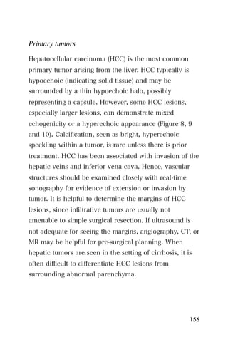 Primary tumors

Hepatocellular carcinoma (HCC) is the most common
primary tumor arising from the liver. HCC typically is
hypoechoic (indicating solid tissue) and may be
surrounded by a thin hypoechoic halo, possibly
representing a capsule. However, some HCC lesions,
especially larger lesions, can demonstrate mixed
echogenicity or a hyperechoic appearance (Figure 8, 9
and 10). Calciﬁcation, seen as bright, hyperechoic
speckling within a tumor, is rare unless there is prior
treatment. HCC has been associated with invasion of the
hepatic veins and inferior vena cava. Hence, vascular
structures should be examined closely with real-time
sonography for evidence of extension or invasion by
tumor. It is helpful to determine the margins of HCC
lesions, since inﬁltrative tumors are usually not
amenable to simple surgical resection. If ultrasound is
not adequate for seeing the margins, angiography, CT, or
MR may be helpful for pre-surgical planning. When
hepatic tumors are seen in the setting of cirrhosis, it is
often diﬃcult to diﬀerentiate HCC lesions from
surrounding abnormal parenchyma.




                                                          156
 