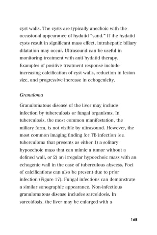 cyst walls. The cysts are typically anechoic with the
occasional appearance of hydatid sand. If the hydatid
cysts result in signiﬁcant mass eﬀect, intrahepatic biliary
dilatation may occur. Ultrasound can be useful in
monitoring treatment with anti-hydatid therapy.
Examples of positive treatment response include
increasing calciﬁcation of cyst walls, reduction in lesion
size, and progressive increase in echogenicity.


Granuloma

Granulomatous disease of the liver may include
infection by tuberculosis or fungal organisms. In
tuberculosis, the most common manifestation, the
miliary form, is not visible by ultrasound. However, the
most common imaging ﬁnding for TB infection is a
tuberculoma that presents as either 1) a solitary
hypoechoic mass that can mimic a tumor without a
deﬁned wall, or 2) an irregular hypoechoic mass with an
echogenic wall in the case of tuberculous abscess. Foci
of calciﬁcations can also be present due to prior
infection (Figure 17). Fungal infections can demonstrate
a similar sonographic appearance. Non-infectious
granulomatous disease includes sarcoidosis. In
sarcoidosis, the liver may be enlarged with a



                                                        168
 