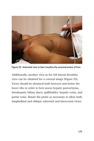 Figure 22. Subcostal view to best visualize the maximal extent of liver.


Additionally, another view in the left lateral decubitis
view can be obtained for a coronal image (Figure 23).
Views should be obtained both between and below the
lower ribs in order to best assess hepatic parenchyma,
intrahepatic biliary ducts, gallbladder, hepatic veins, and
portal veins. Rotate the probe as necessary to allow both
longitudinal and oblique subcostal and intercostal views.




                                                                     177
 