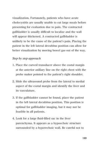 visualization. Fortunately, patients who have acute
cholecystitis are usually unable to eat large meals before
presenting for evaluation due to pain. The contracted
gallbladder is usually diﬃcult to localize and the wall
will appear thickened. A contracted gallbladder is
unlikely to be the cause of the patient s pain. Placing the
patient in the left lateral decubitus position can allow for
better visualization by moving bowel gas out of the way.

Step by step approach

1. Place the curved transducer above the costal margin
  at the anterior axillary line on the right chest with the
  probe maker pointed to the patient s right shoulder.

2. Slide the ultrasound probe from the lateral to medial
  aspect of the costal margin and identify the liver and
  its vasculature.

3. If the gallbladder cannot be found, place the patient
  in the left lateral decubitus position. This position is
  optimal for gallbladder imaging, but it may not be
  feasible in all patients.

4. Look for a large ﬂuid-ﬁlled sac in the liver
  parenchyma. It appears as a hypoechoic structure
  surrounded by a hyperechoic wall. Be careful not to


                                                          199
 