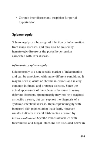 • Chronic liver disease and suspicion for portal
     hypertension



Splenomegaly

Splenomegaly can be a sign of infection or inﬂammation
from many diseases, and may also be caused by
hematologic disease or the portal hypertension
associated with liver disease.


Inﬂammatory splenomegaly

Splenomegaly is a non-speciﬁc marker of inﬂammation
and can be associated with many diﬀerent conditions. It
may be seen in acute or chronic infections and is very
common in fungal and protozoa diseases. Since the
actual appearance of the spleen is the same in many
diﬀerent disorders, splenomegaly may not help diagnose
a speciﬁc disease, but can support the diagnosis of a
systemic infectious disease. Hepatosplenomegaly with
increased skin pigmentation (kala-azar), however,
usually indicates visceral leishmaniasis caused by
Leishmania donovani. Speciﬁc lesions associated with
tuberculosis and fungal infections are discussed below in



                                                        205
 