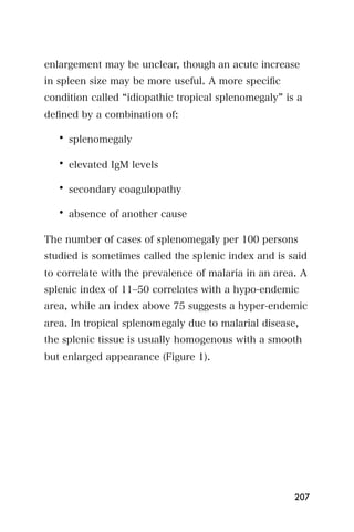 enlargement may be unclear, though an acute increase
in spleen size may be more useful. A more speciﬁc
condition called idiopathic tropical splenomegaly is a
deﬁned by a combination of:

   • splenomegaly

   • elevated IgM levels

   • secondary coagulopathy

   • absence of another cause

The number of cases of splenomegaly per 100 persons
studied is sometimes called the splenic index and is said
to correlate with the prevalence of malaria in an area. A
splenic index of 11‒50 correlates with a hypo-endemic
area, while an index above 75 suggests a hyper-endemic
area. In tropical splenomegaly due to malarial disease,
the splenic tissue is usually homogenous with a smooth
but enlarged appearance (Figure 1).




                                                      207
 