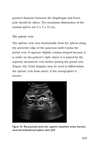 greatest diameter between the diaphragm and lower
pole should be taken. The maximum dimensions of the
normal spleen are 5 x 7 x 12 cm.


The splenic vein

The splenic vein runs horizontally from the spleen along
the posterior edge of the pancreas until it joins the
portal vein. It appears slightly comma-shaped because it
is wider on the patient s right where it is joined by the
superior mesenteric vein before joining the portal vein
(Figure 10), Color Doppler may be used to diﬀerentiate
the splenic vein from artery, if the sonographer is
unsure.




Figure 10. The proximal aorta (A), superior mesenteric artery (arrow),
renal (arrowhead) and splenic veins (SV)


                                                                  219
 