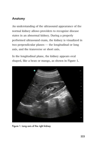 Anatomy

An understanding of the ultrasound appearance of the
normal kidney allows providers to recognize disease
states in an abnormal kidney. During a properly
performed ultrasound exam, the kidney is visualized in
two perpendicular planes ̶ the longitudinal or long
axis, and the transverse or short axis.

In the longitudinal plane, the kidney appears oval
shaped, like a bean or mango, as shown in Figure 1.




Figure 1. Long axis of the right kidney



                                                      223
 