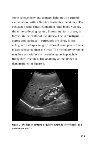some echogenicity and appears light gray on careful
examination. Within Gerota s fascia lies the kidney. The
echogenic renal sinus, containing renal blood vessels,
the urine collecting system, ﬁbrous and fatty tissue, is
located in the center of the kidney. The parenchyma ̶
cortex and medulla ̶ surrounds the sinus, is less
echogenic and appears gray. Normal renal parenchyma
is less echogenic than the liver. The medullary pyramids
may be seen within the parenchyma as hypoechoic
triangular structures. The anatomy of the kidney is
demonstrated in Figure 3.




Figure 3. The kidney contains medullary pyramids (arrowheads) and
an outer cortex (*)


                                                               225
 