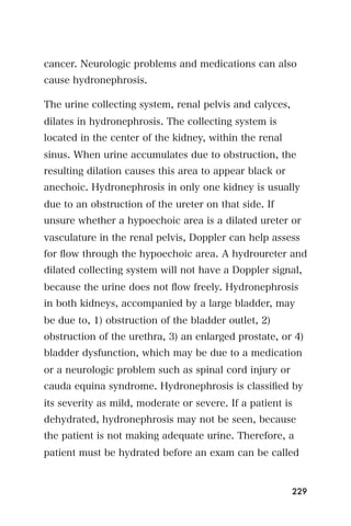 cancer. Neurologic problems and medications can also
cause hydronephrosis.

The urine collecting system, renal pelvis and calyces,
dilates in hydronephrosis. The collecting system is
located in the center of the kidney, within the renal
sinus. When urine accumulates due to obstruction, the
resulting dilation causes this area to appear black or
anechoic. Hydronephrosis in only one kidney is usually
due to an obstruction of the ureter on that side. If
unsure whether a hypoechoic area is a dilated ureter or
vasculature in the renal pelvis, Doppler can help assess
for ﬂow through the hypoechoic area. A hydroureter and
dilated collecting system will not have a Doppler signal,
because the urine does not ﬂow freely. Hydronephrosis
in both kidneys, accompanied by a large bladder, may
be due to, 1) obstruction of the bladder outlet, 2)
obstruction of the urethra, 3) an enlarged prostate, or 4)
bladder dysfunction, which may be due to a medication
or a neurologic problem such as spinal cord injury or
cauda equina syndrome. Hydronephrosis is classiﬁed by
its severity as mild, moderate or severe. If a patient is
dehydrated, hydronephrosis may not be seen, because
the patient is not making adequate urine. Therefore, a
patient must be hydrated before an exam can be called


                                                         229
 