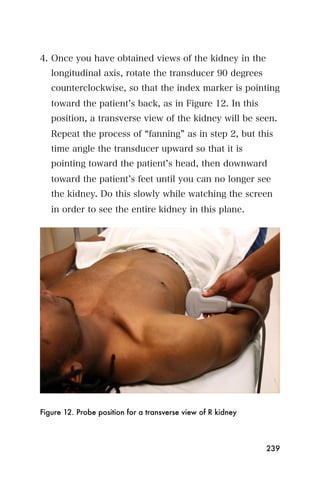 4. Once you have obtained views of the kidney in the
   longitudinal axis, rotate the transducer 90 degrees
   counterclockwise, so that the index marker is pointing
   toward the patient s back, as in Figure 12. In this
   position, a transverse view of the kidney will be seen.
   Repeat the process of fanning as in step 2, but this
   time angle the transducer upward so that it is
   pointing toward the patient s head, then downward
   toward the patient s feet until you can no longer see
   the kidney. Do this slowly while watching the screen
   in order to see the entire kidney in this plane.




Figure 12. Probe position for a transverse view of R kidney



                                                              239
 