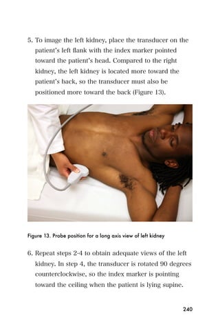5. To image the left kidney, place the transducer on the
   patient s left ﬂank with the index marker pointed
   toward the patient s head. Compared to the right
   kidney, the left kidney is located more toward the
   patient s back, so the transducer must also be
   positioned more toward the back (Figure 13).




Figure 13. Probe position for a long axis view of left kidney


6. Repeat steps 2-4 to obtain adequate views of the left
   kidney. In step 4, the transducer is rotated 90 degrees
   counterclockwise, so the index marker is pointing
   toward the ceiling when the patient is lying supine.


                                                                240
 